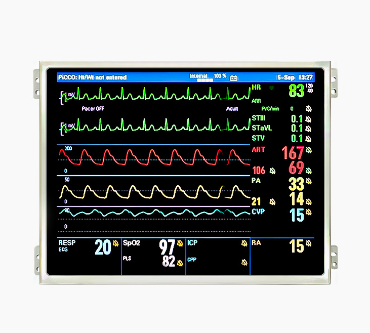 10.4 inch 1024x768 LCD display for patient monitor (HC104IM65065-B24V01)