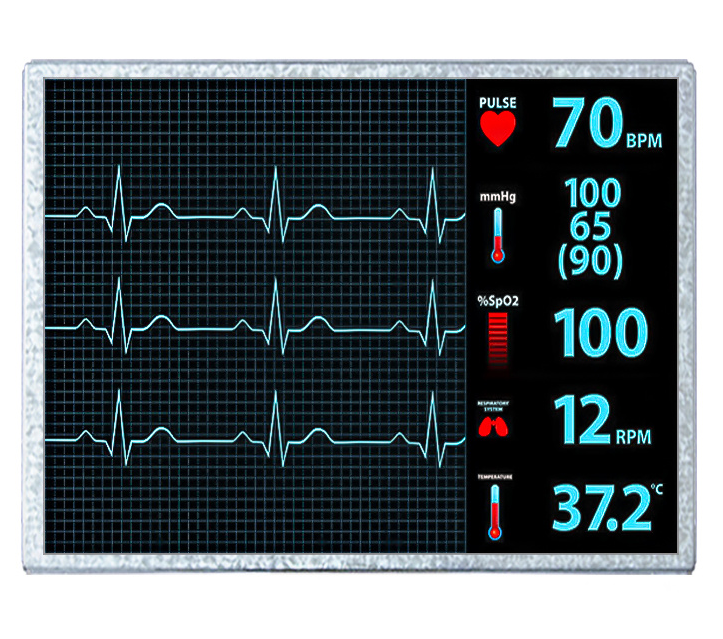 10.4 inch 1024x768 LCD display for patient monitor (HC104IM65065-B24)